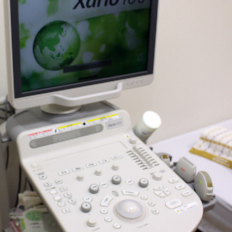 超音波（エコー）診断装置